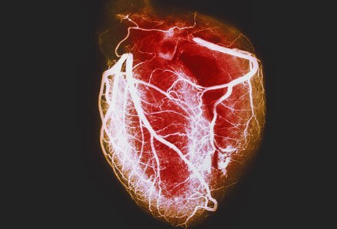 Myths about heart desease